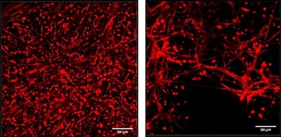 Collink.3D (left image) exhibited skeletal Muscle elongation while Matrigel (right image) appeared non-uniform on day 7 (Technion)